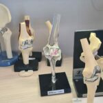 Knee Replacement